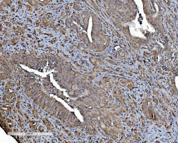 2 - Anti-REA/PHB2 Antibody Picoband™ (monoclonal, 2B5) ABO15050