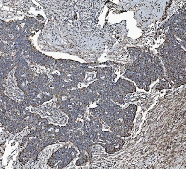 2 - Anti-REA/PHB2 Antibody Picoband™ (monoclonal, 2B5) ABO15050
