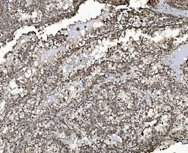 2 - Anti-REA/PHB2 Antibody Picoband™ (monoclonal, 2B5) ABO15050