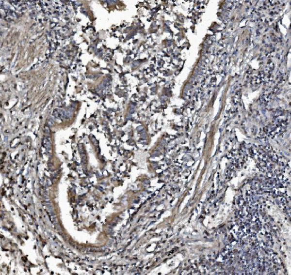 2 - Anti-REA/PHB2 Antibody Picoband™ (monoclonal, 2B5) ABO15050