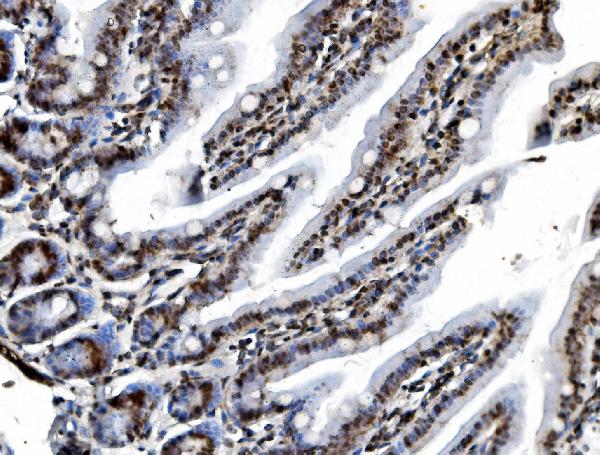 2 - Anti-REA/PHB2 Antibody Picoband™ (monoclonal, 2B5) ABO15050
