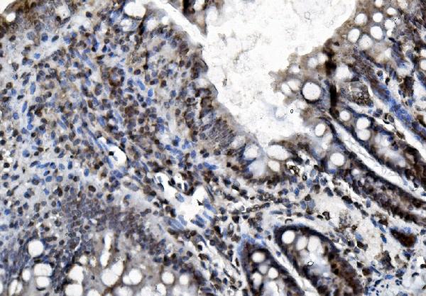2 - Anti-REA/PHB2 Antibody Picoband™ (monoclonal, 2B5) ABO15050