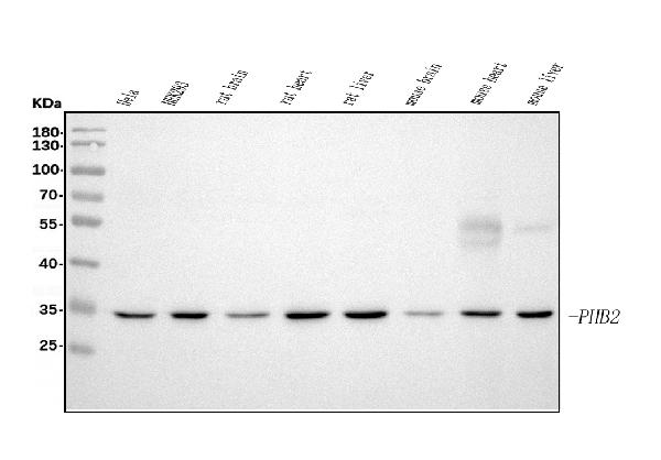 1 - Anti-REA/PHB2 Antibody Picoband™ (monoclonal, 2B5) ABO15050