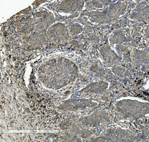 2 - Anti-Integrin beta 5/ITGB5 Antibody Picoband™ (monoclonal, 9E2) ABO15051