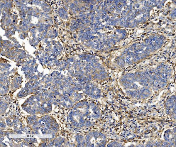 2 - Anti-Integrin beta 5/ITGB5 Antibody Picoband™ (monoclonal, 9E2) ABO15051