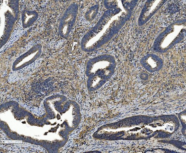2 - Anti-Integrin beta 5/ITGB5 Antibody Picoband™ (monoclonal, 9E2) ABO15051