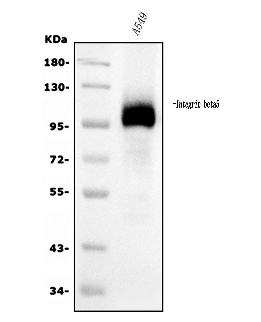 1 - Anti-Integrin beta 5/ITGB5 Antibody Picoband™ (monoclonal, 9E2) ABO15051