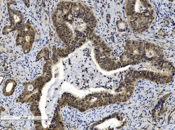 2 - Anti-Cbx8 Antibody Picoband™ (monoclonal, 8G7) ABO15052