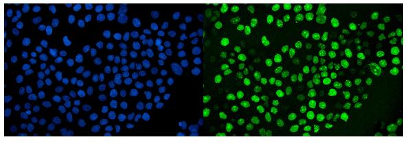 3 - Anti-Ki67 Antibody Picoband™ (monoclonal, 5E12) ABO15053