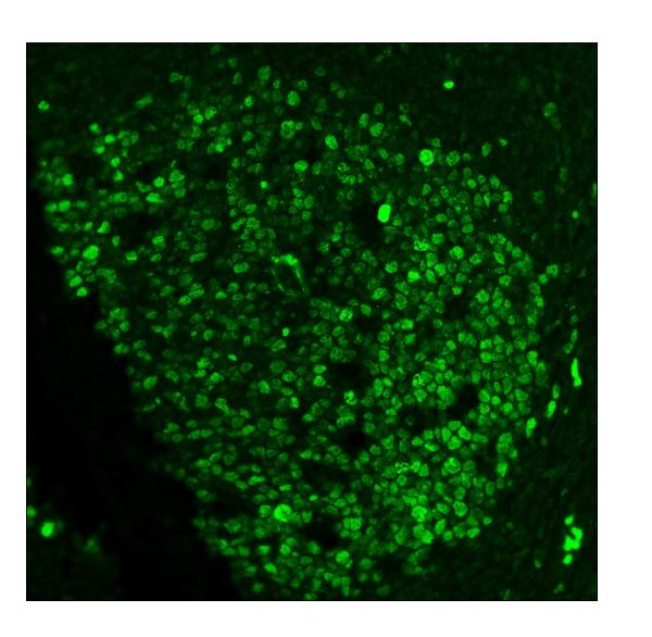 3 - Anti-Ki67 Antibody Picoband™ (monoclonal, 5E12) ABO15053