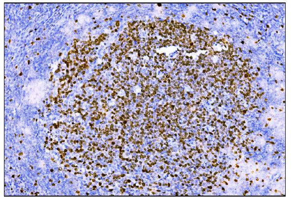 2 - Anti-Ki67 Antibody Picoband™ (monoclonal, 5E12) ABO15053