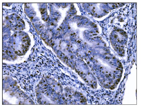 2 - Anti-Ki67 Antibody Picoband™ (monoclonal, 5E12) ABO15053