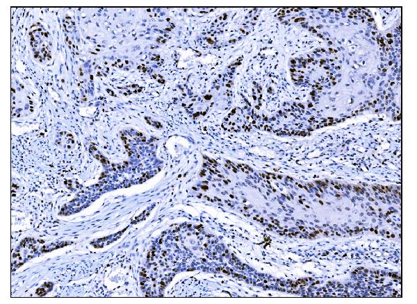 2 - Anti-Ki67 Antibody Picoband™ (monoclonal, 5E12) ABO15053