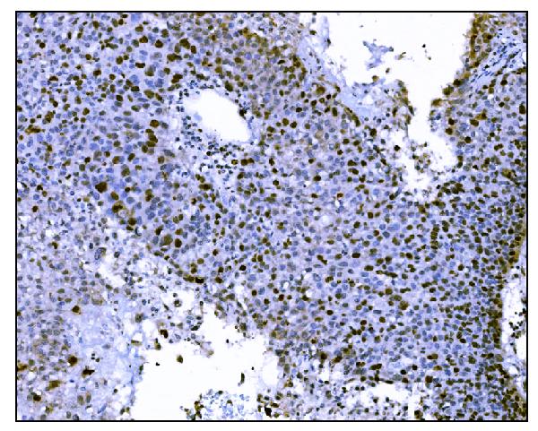 2 - Anti-Ki67 Antibody Picoband™ (monoclonal, 5E12) ABO15053