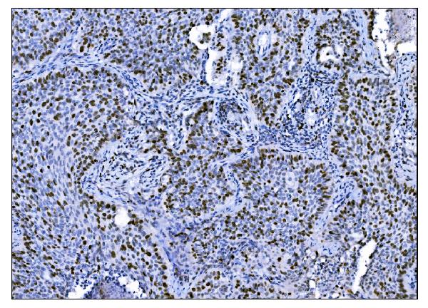 2 - Anti-Ki67 Antibody Picoband™ (monoclonal, 5E12) ABO15053
