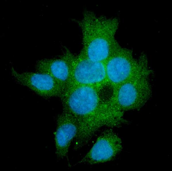 3 - Anti-TGFBR2 Antibody Picoband™ (monoclonal, 2F11) ABO15055