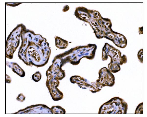 2 - Anti-TGFBR2 Antibody Picoband™ (monoclonal, 2F11) ABO15055