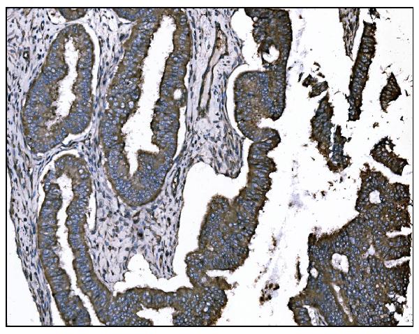 2 - Anti-TGFBR2 Antibody Picoband™ (monoclonal, 2F11) ABO15055