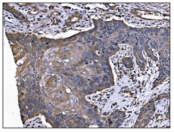 2 - Anti-TGFBR2 Antibody Picoband™ (monoclonal, 2F11) ABO15055