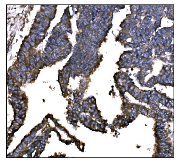 2 - Anti-IGF2R Antibody Picoband™ (monoclonal, 4I11) ABO15056