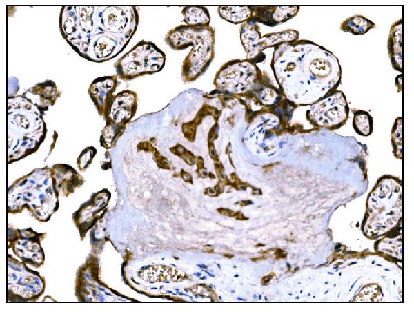 2 - Anti-IGF2R Antibody Picoband™ (monoclonal, 4I11) ABO15056