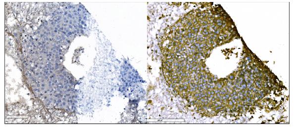 2 - Anti-IGF2R Antibody Picoband™ (monoclonal, 6G2) ABO15057
