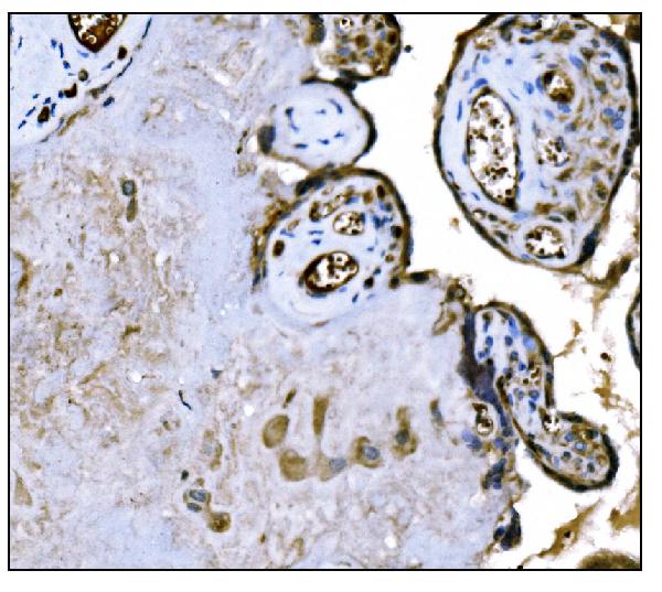 2 - Anti-IGF2R Antibody Picoband™ (monoclonal, 6G2) ABO15057