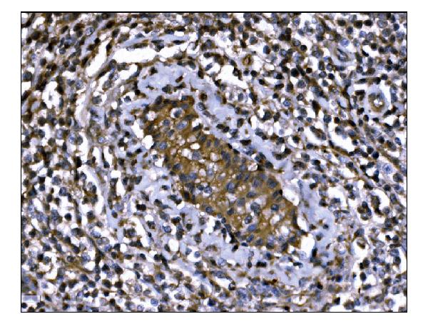 2 - Anti-IGF2R Antibody Picoband™ (monoclonal, 6G2) ABO15057