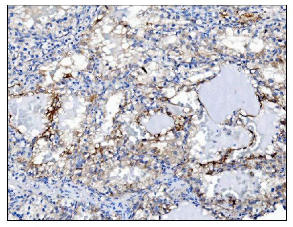 2 - Anti-PGP9.5 Antibody Picoband™ (monoclonal, 3E4) ABO15058