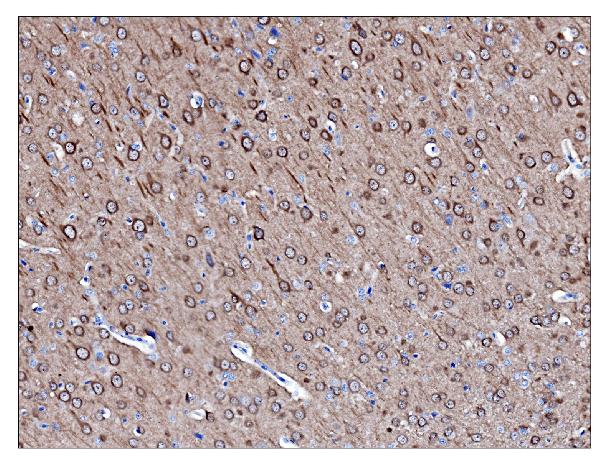 2 - Anti-PGP9.5 Antibody Picoband™ (monoclonal, 3E4) ABO15058