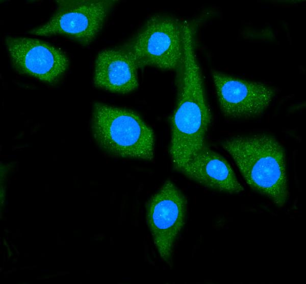 3 - Anti-Hsp90 alpha Antibody Picoband™ (monoclonal, 6B5) ABO15059