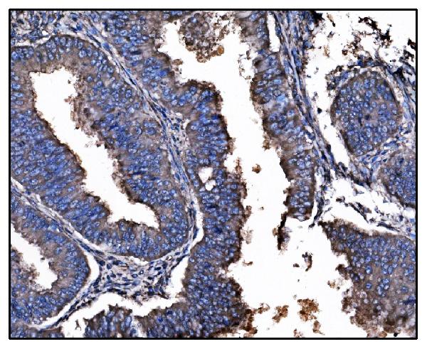 2 - Anti-Hsp90 alpha Antibody Picoband™ (monoclonal, 6B5) ABO15059