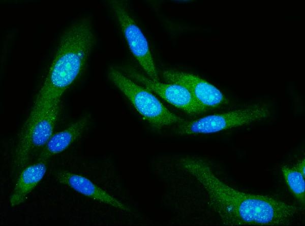 3 - Anti-GSDMD Antibody Picoband™ (monoclonal, 6D11) ABO15066
