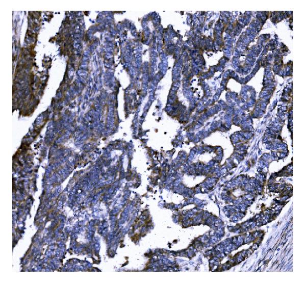 2 - Anti-GSDMD Antibody Picoband™ (monoclonal, 6D11) ABO15066