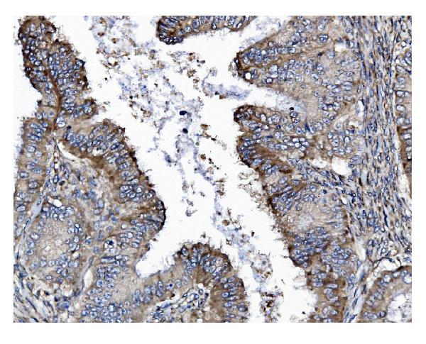 2 - Anti-GSDMD Antibody Picoband™ (monoclonal, 6D11) ABO15066
