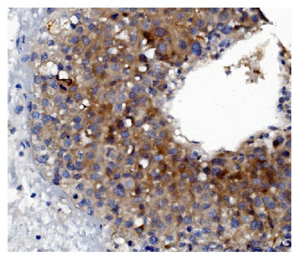 2 - Anti-GSDMD Antibody Picoband™ (monoclonal, 3D5) ABO15067