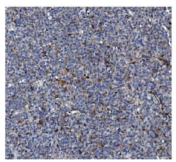 2 - Anti-GSDMD Antibody Picoband™ (monoclonal, 3D5) ABO15067
