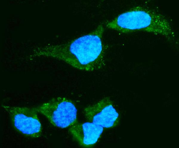3 - Anti-Alpha A Crystallin Antibody Picoband™ (monoclonal, 10B9) ABO15070
