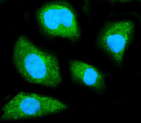 3 - Anti-GNB1 Antibody Picoband™ (monoclonal, 11F9) ABO15072