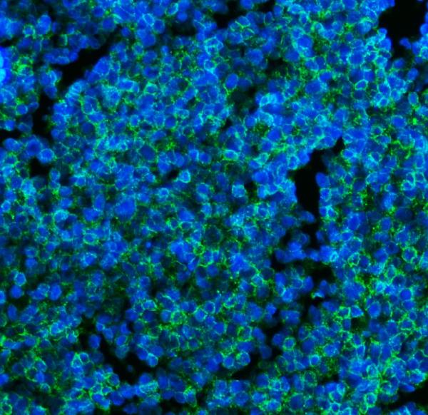 3 - Anti-CD45 Antibody Picoband™ (monoclonal, 3H6) ABO15074