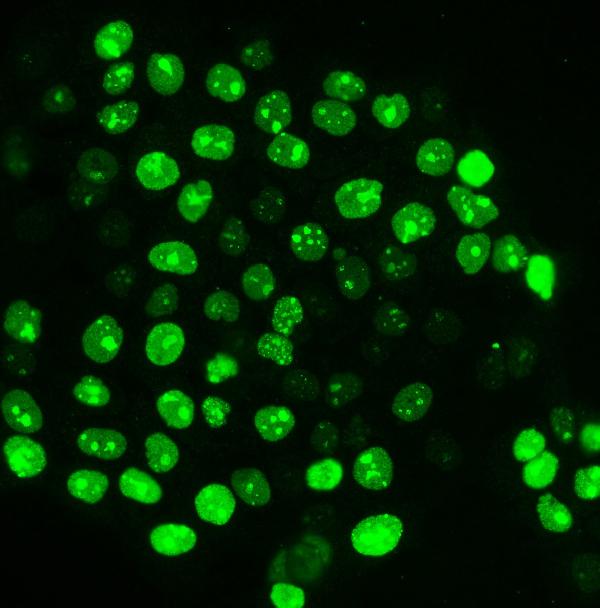 3 - Anti-Ki67 Antibody Picoband™ (monoclonal, 5C7) ABO15075