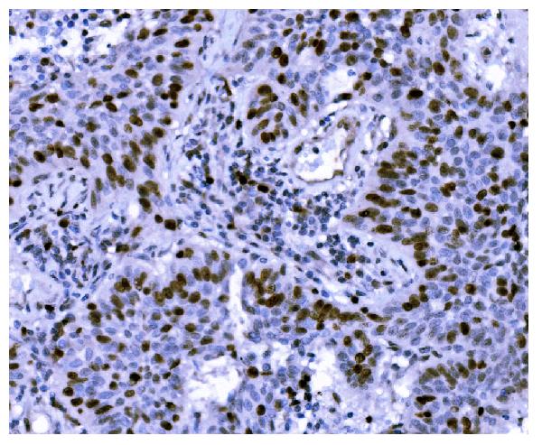 2 - Anti-Ki67 Antibody Picoband™ (monoclonal, 5C7) ABO15075