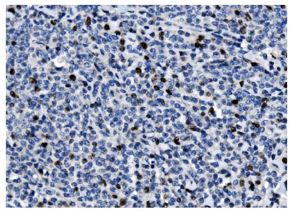 2 - Anti-Ki67 Antibody Picoband™ (monoclonal, 5C7) ABO15075