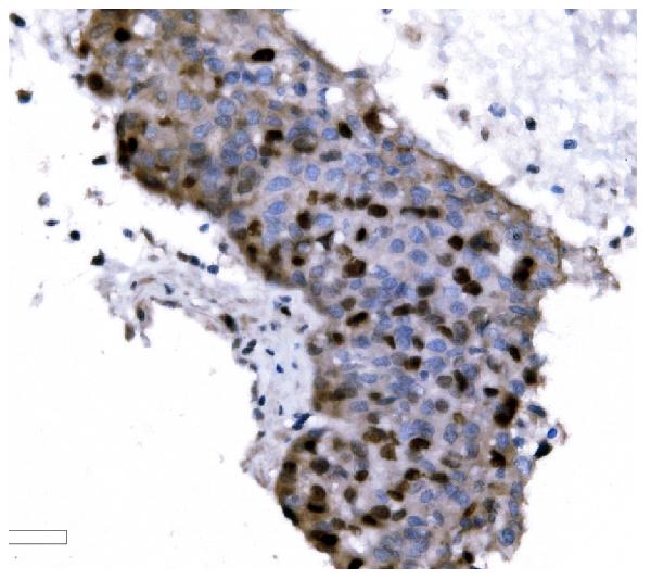 2 - Anti-Ki67 Antibody Picoband™ (monoclonal, 5C7) ABO15075