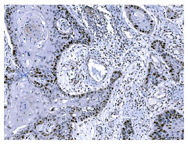 2 - Anti-Ki67 Antibody Picoband™ (monoclonal, 5C7) ABO15075