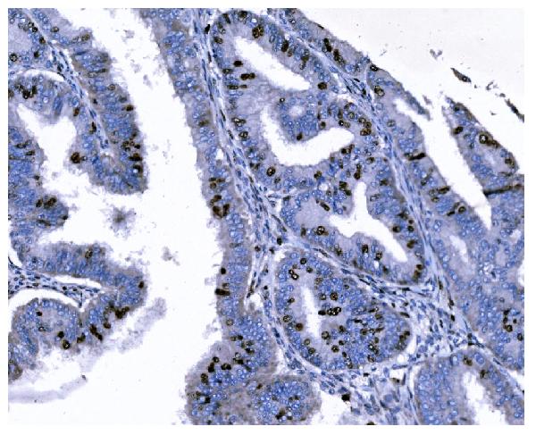 2 - Anti-Ki67 Antibody Picoband™ (monoclonal, 5C7) ABO15075