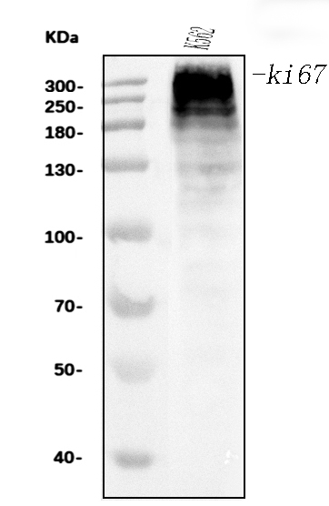 1 - Anti-Ki67 Antibody Picoband™ (monoclonal, 5C7) ABO15075