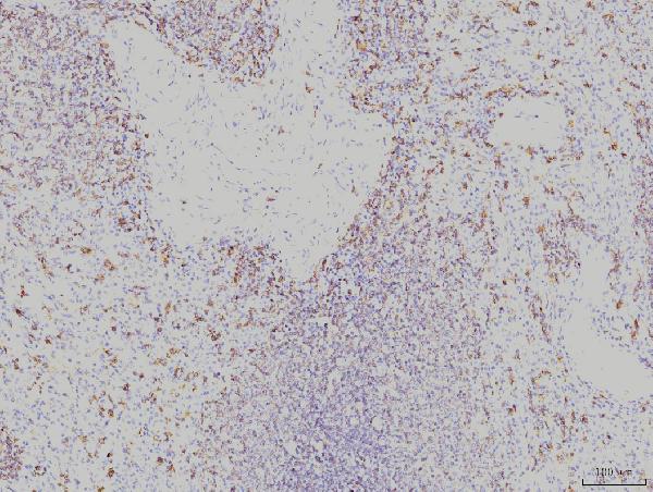 2 - Anti-Rab11A Antibody Picoband™ (monoclonal, 4H9) ABO15077
