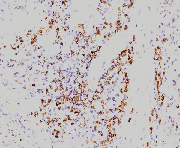 2 - Anti-Rab11A Antibody Picoband™ (monoclonal, 4H9) ABO15077