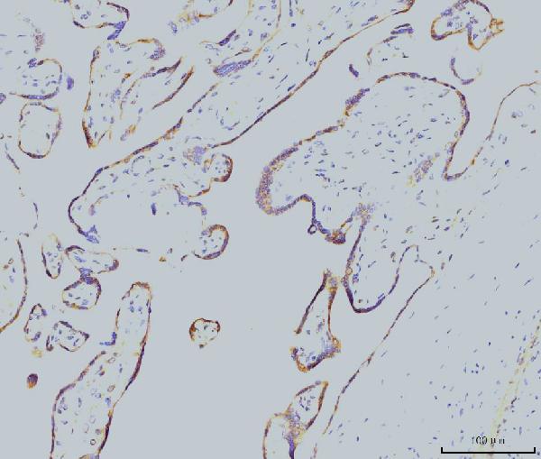 2 - Anti-Rab11A Antibody Picoband™ (monoclonal, 4H9) ABO15077